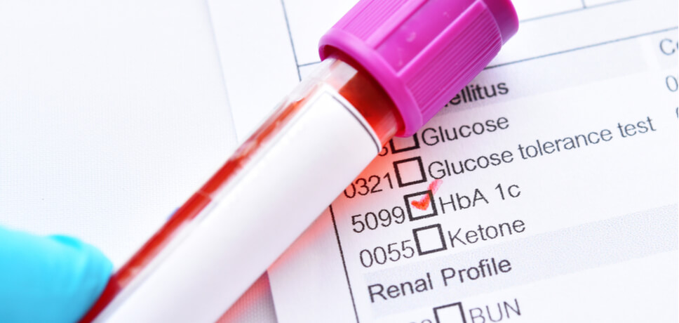 What is HbA1c? - Health Centre by Manual | Medical Information ...